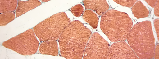 512px-Skeletal_muscle_cut_in_cross