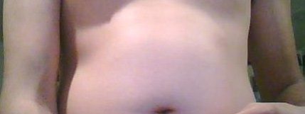 Overweight_waistline